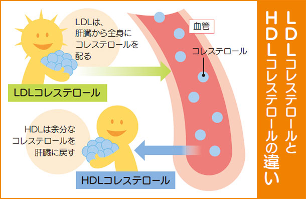 LDLコレステロールとHDLコレステロールの違い　LDLは肝臓から全身にコレステロールを配る　HDLは余分なコレステロールを肝臓に戻す