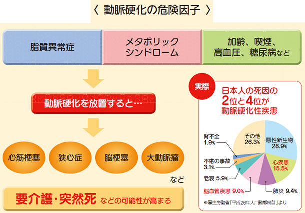 動脈硬化の危険因子 脂質異常症 メタボリックシンドローム 加齢、喫煙、高血圧、糖尿病など 心筋梗塞 狭心症 脳梗塞 大動脈瘤 日本人の死因の2位と4位が動脈硬化性疾患