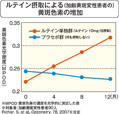ルテイン摂取による（加齢黄斑変性患者の）黄斑色素の増加